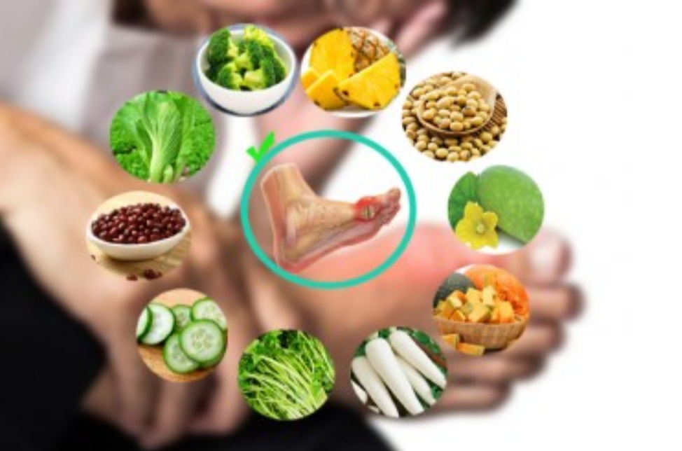 Lá Nương Gút Đẩy Lùi Bệnh Gout Trả Lại 1 Sức Khoẻ Tốt Cho Bạn