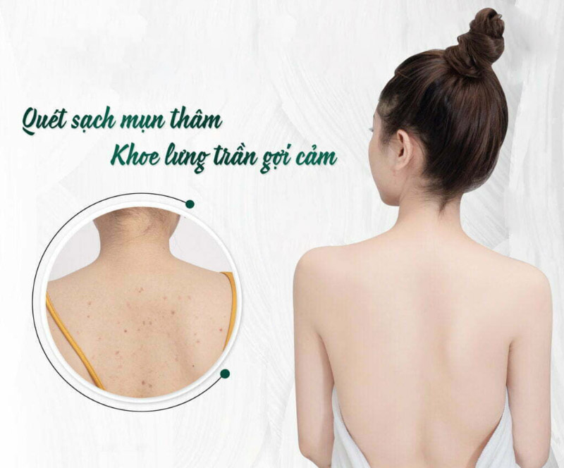 Tắm trắng Xskin chính là một sản phẩm được thiết kế phù hợp hoàn toàn với làn da châu Á 2020